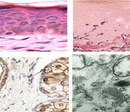 Histopathological techniques