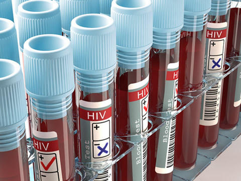 Rack of HIV blood sample tubes