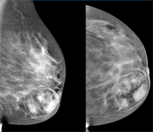National Breast Imaging Academy