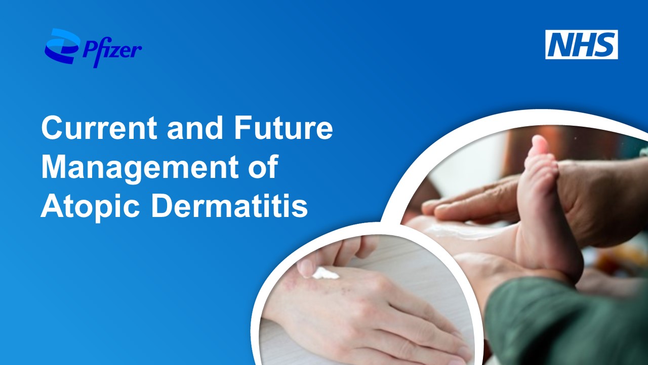 New programme on managing atopic dermatitis now available