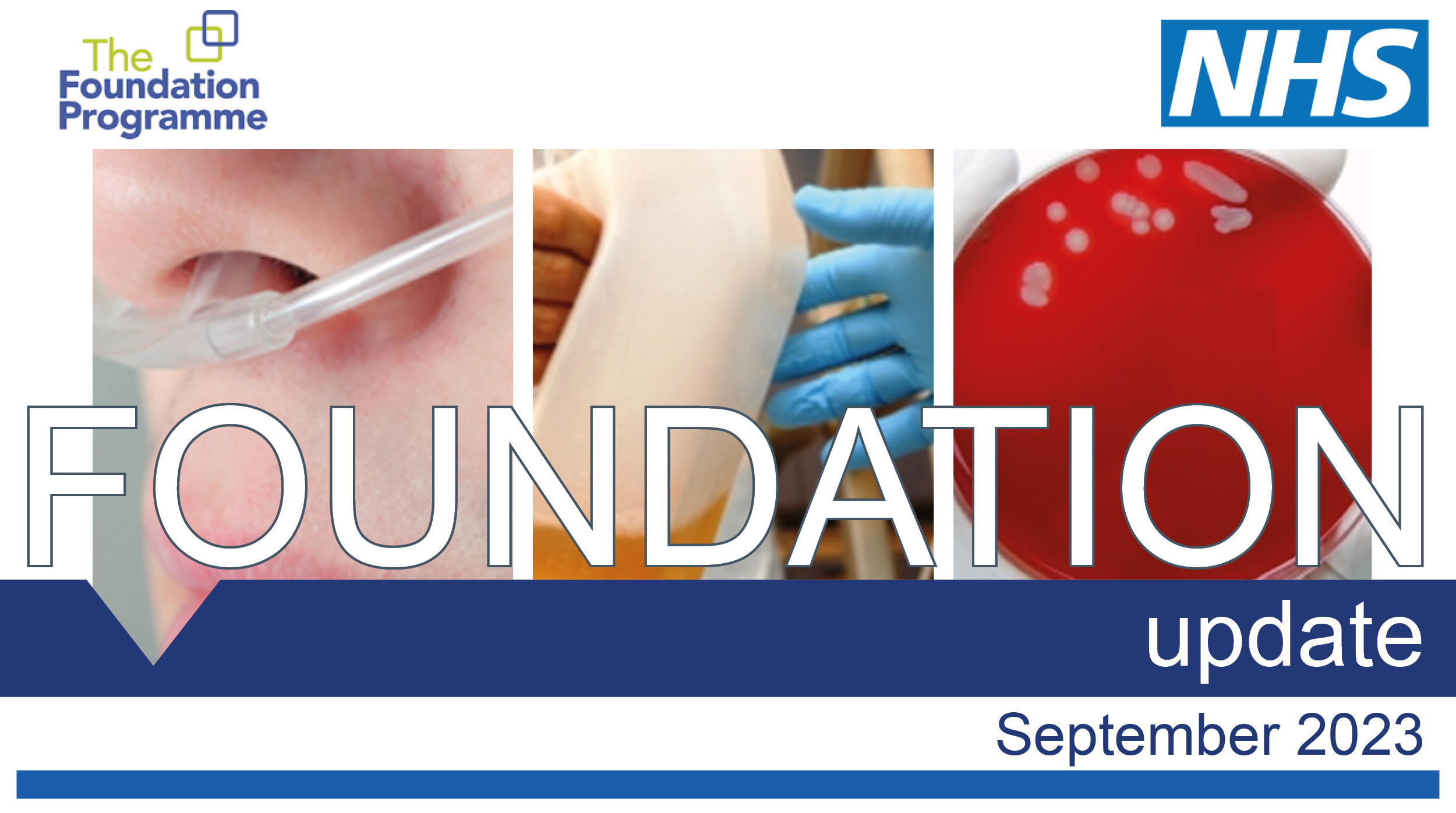 A collage of photos showing management of acute conditions including fluid status, sepsis and arterial blood gas sampling and interpretation.