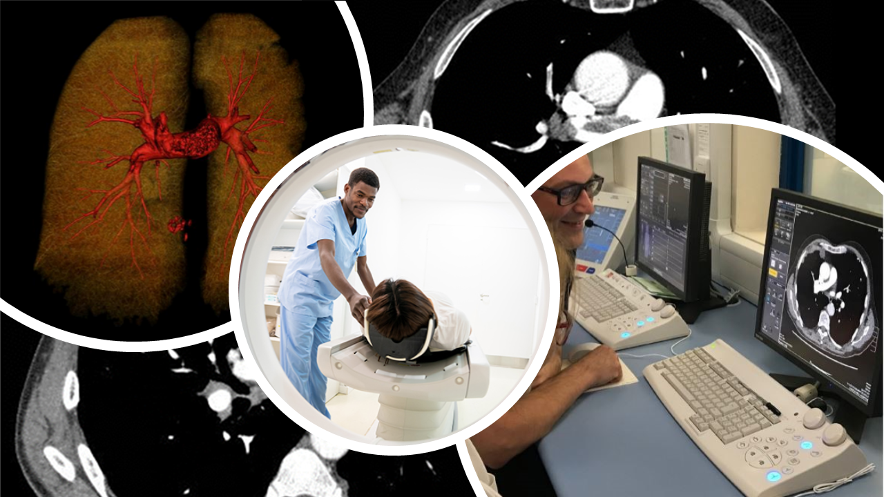 a collage of photos showing staff and clinical images, depicting radiographers recognising pulmonary emboli in CT.