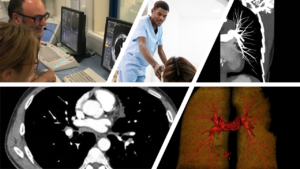 a collage of photos showing staff and clinical images, depicting radiographers recognising pulmonary emboli in CT.